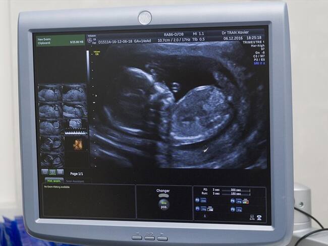 En octubre de 2018 se estableció que el derecho de las mujeres a abortar seguirá siendo el mismo al que existe desde hace 12 años en el país. Foto: Getty Images