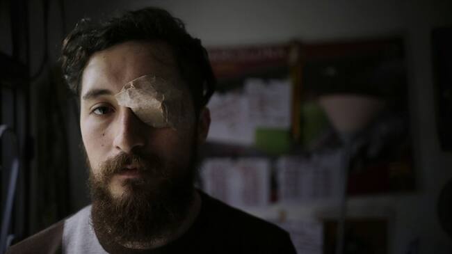 Cristian Rodolfo Rodríguez, el joven estudiante que resultó herido por parte de un agente del ESMAD durante las movilizaciones del Paro Nacional el pasado 16 de diciembre. Foto: Colprensa