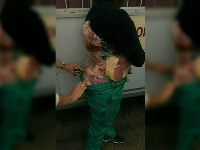 Carne de contrabando atada al cuerpo es ingresada desde Venezuela hacia Cúcuta. Foto: Secretaría de Hacienda de Norte de Santander