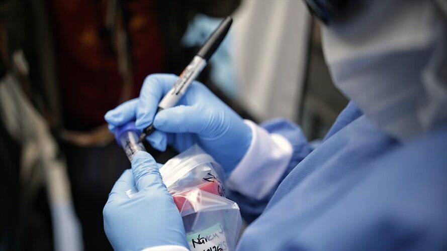 Casos de COVID-19 en Colombia. Foto: Colprensa