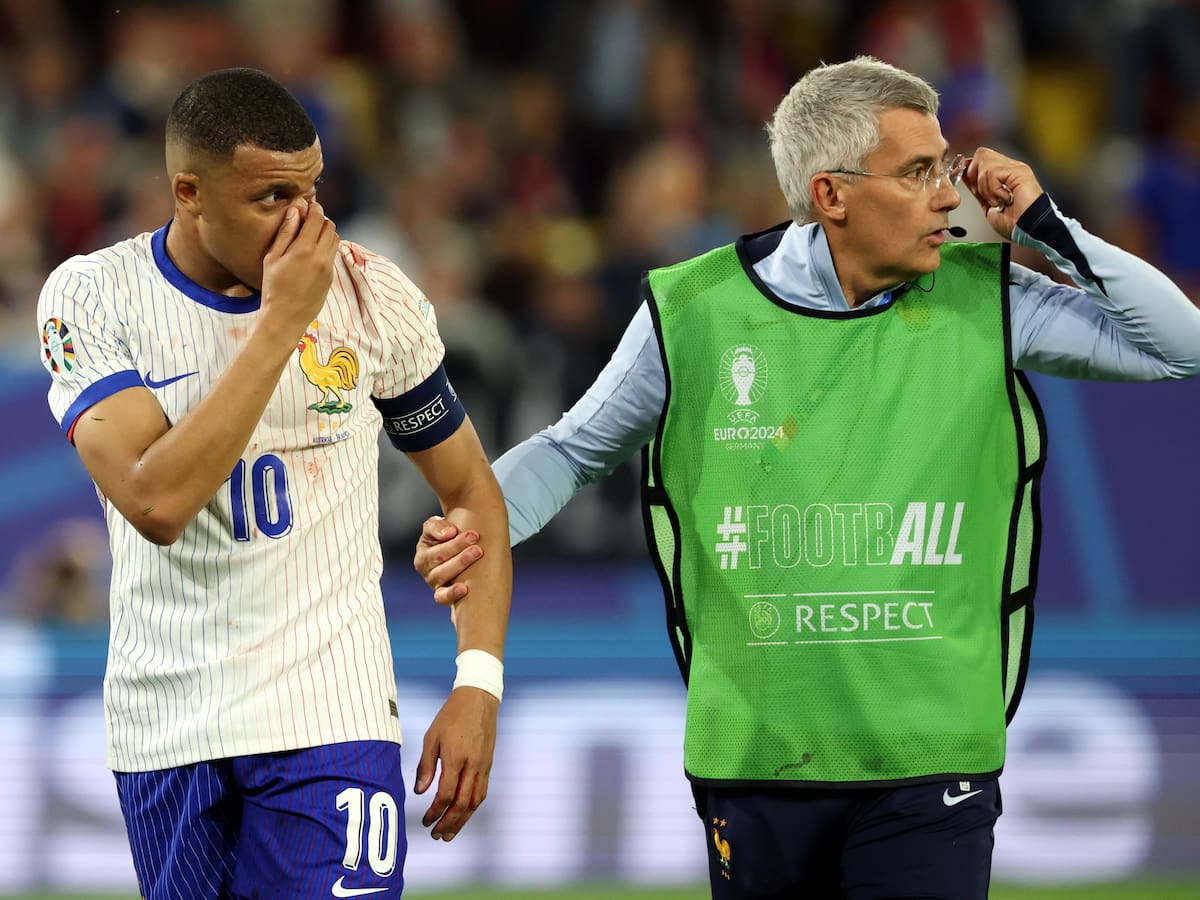 Kylian Mbappé no será operado tras la lesión en la nariz que sufrió ante Austria