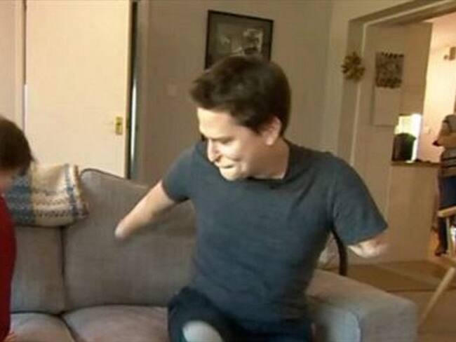 Víctima de una rara enfermedad, Alex Lewis debió ser sometido a una amputación de sus cuatro miembros para sobrevivir.. Foto: BBC Mundo