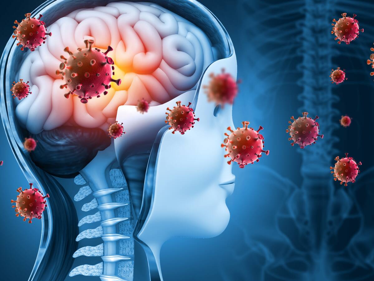 ¿Cómo diferenciar un dolor de cabeza fuerte de una meningitis?: Experto responde