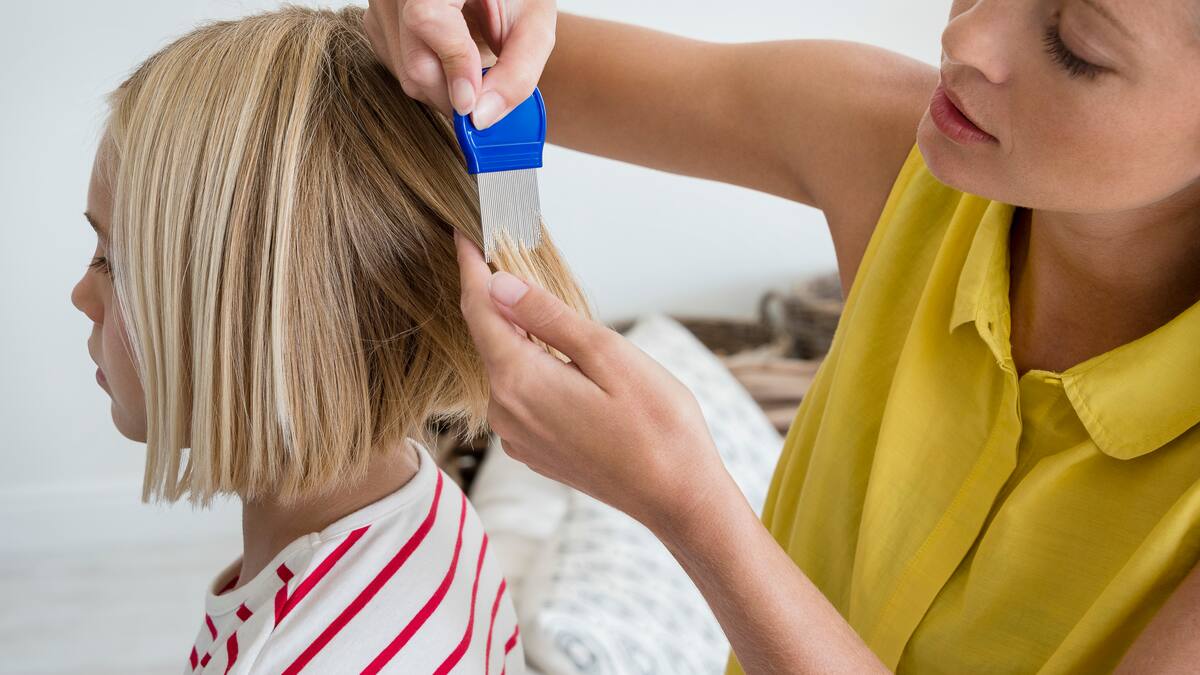 ¿Cómo matar los piojos y liendres cuando aparecene en los niños? Experto respondió