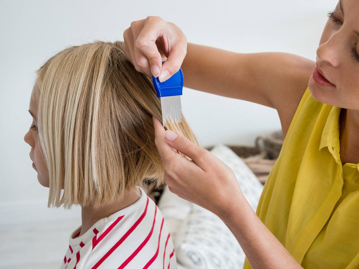 ¿Cómo se pueden eliminar los piojos y las liendres en los niños? Experto respondió