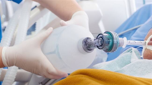 Imagen de referencia de una persona en UCI por COVID-19. Foto: Getty Images / Jackyenjoyphotography