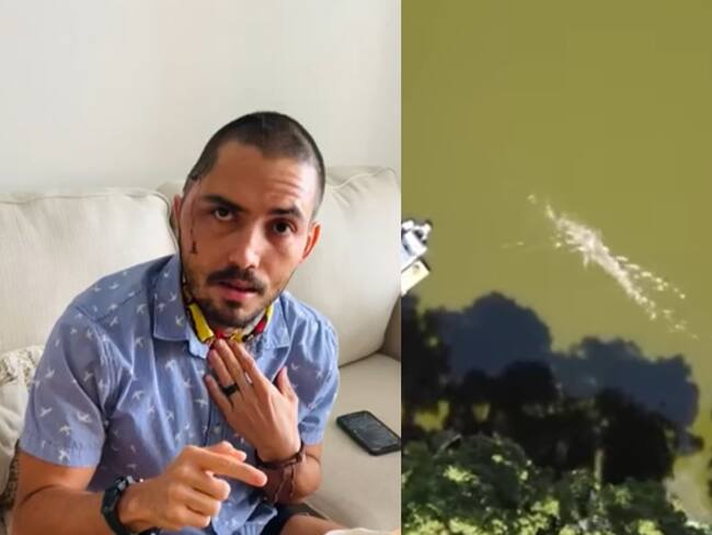 Me fracturó la mandíbula en cuatro partes: bombero que sobrevivió a ataque de caimán