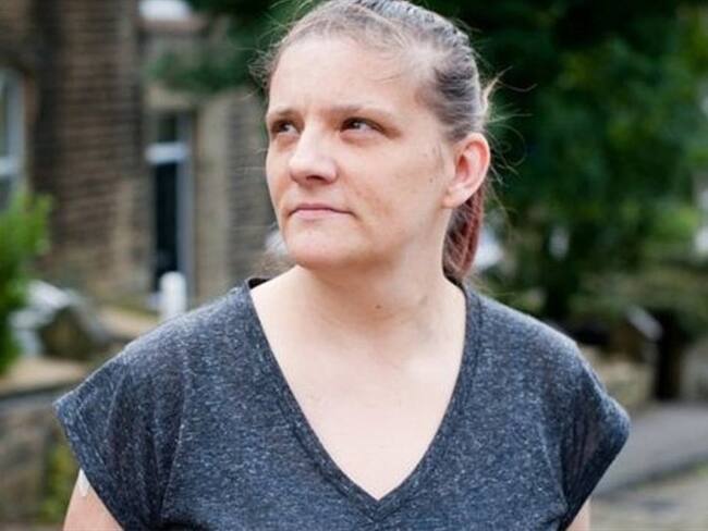 Mandy Littlewood sufre una enfermedad hereditaria.. Foto: BBC Mundo