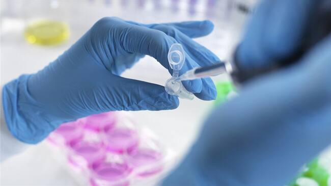 El virólogo francés Luc Montagnier es uno de los descubridores del VIH y sus afirmaciones sobre el origen virus han generado polémica.. Foto: Getty Images