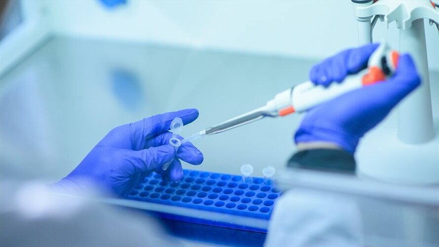 Imagen de referencia de toma de muestras de ADN. Foto: Getty Images / CMB