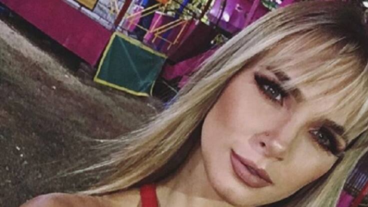 “Las víctimas de biopolímeros no sabíamos qué nos iban a aplicar”: Elizabeth Loaiza