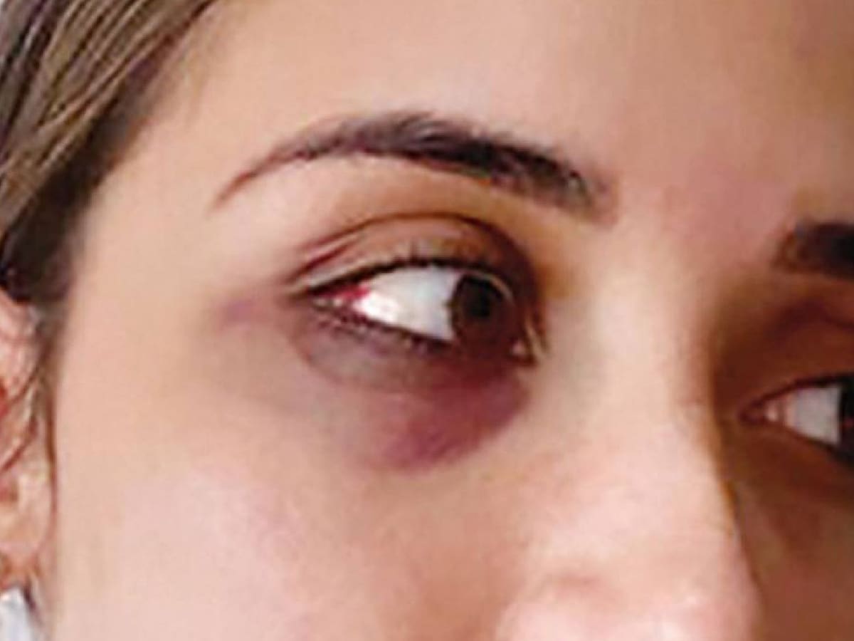 Apartaron del cargo a médico denunciado de brutal golpiza a mujer en Bucaramanga