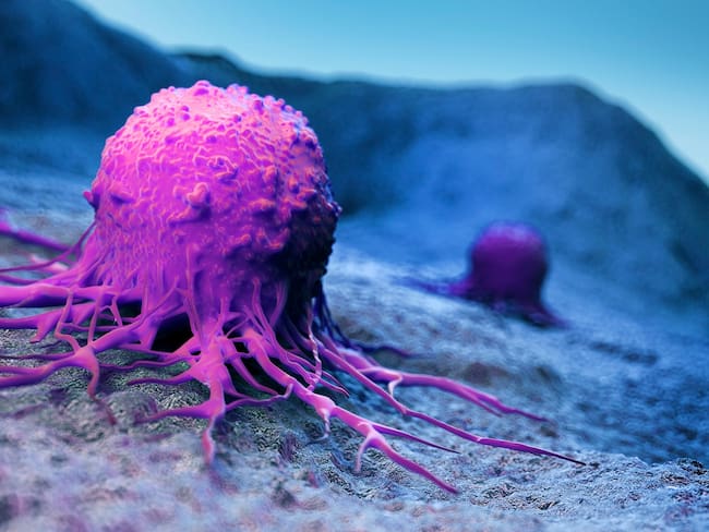 ¿Por qué incidencia de cáncer en Colombia aumentará 69% para 2040? Experto responde
