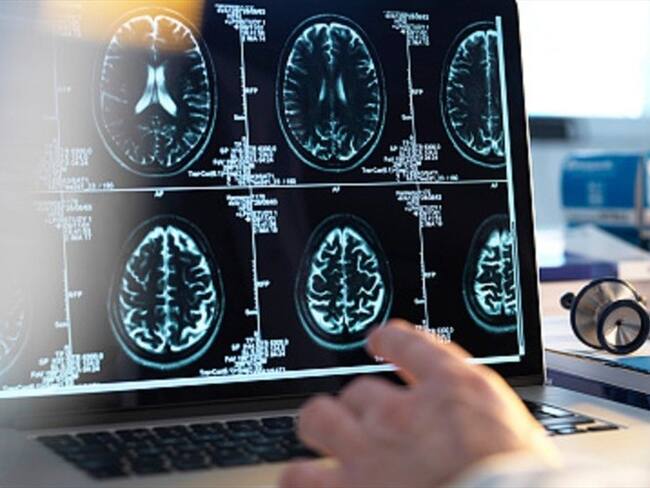 Un equipo de neuroingenieros de la Universidad de Columbia (EE. UU.) ha creado un sistema capaz de reconocer las palabras de una persona leyendo su actividad cerebral.. Foto: Getty Images