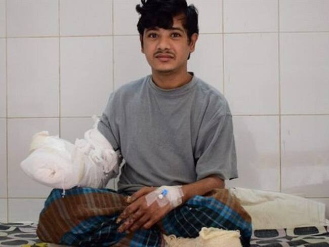 Bajandar ha sido sometido a 16 operaciones.. Foto: BBC Mundo