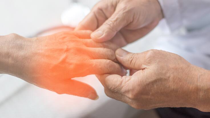 Así es la neuropatía periférica diabética: doctor explicó el ABC de esta enfermedad