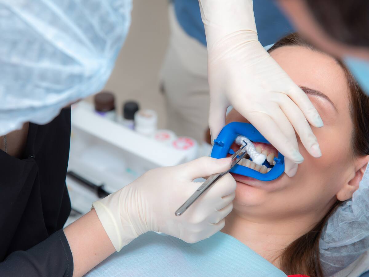 Armonización orofacial: ¿qué es y cuál es el tratamiento?