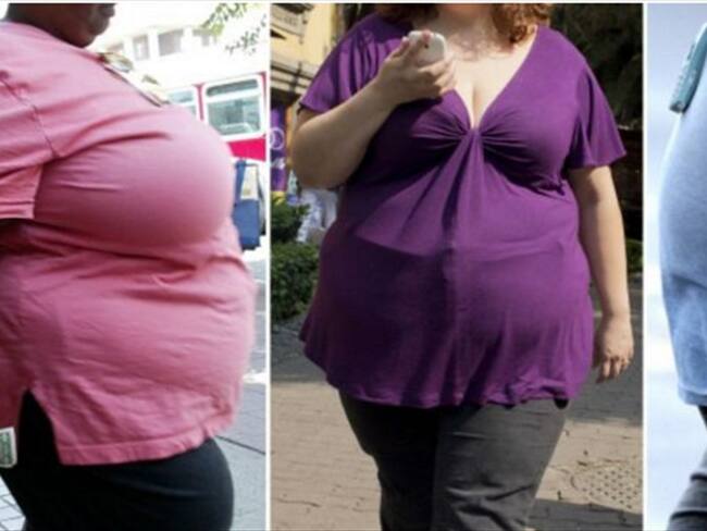 La cifra de obesos se incrementó de 105 a 641 millones de personas en los últimos 40 años. Foto: BBC Mundo