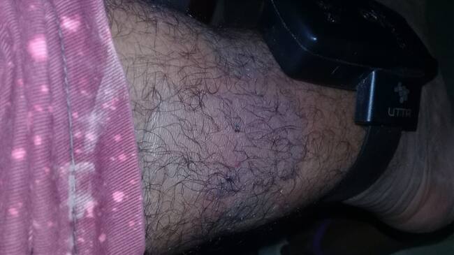 Varios detenidos en domiciliaria en Bogotá reportaron los daños y la peligrosidad de los brazaletes. Foto: W Radio