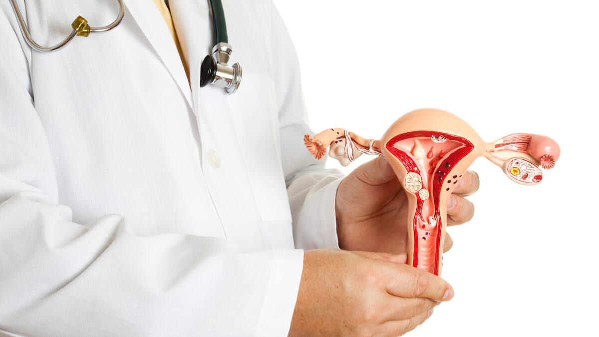 Miomas uterinos: qué son, síntomas y cómo tratarlos