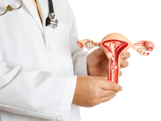 Miomas uterinos: qué son, síntomas y cómo tratarlos
