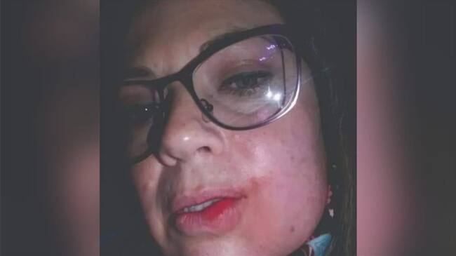 Los hechos ocurrieron el pasado domingo, cuando al parecer el concejal salía de una fiesta en estado de embriaguez. Foto: Cortesía