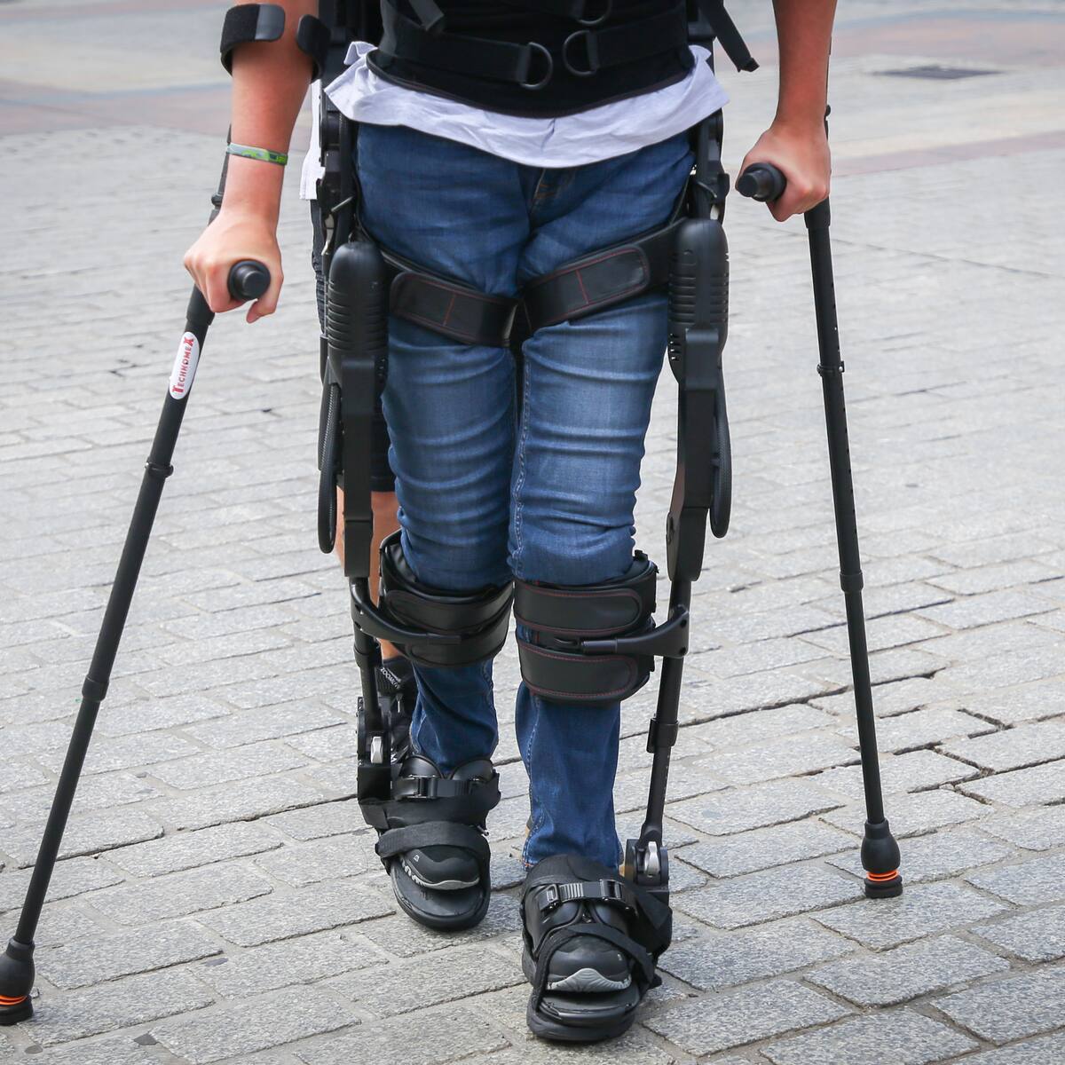 “Fue emocionante”: paciente paralítico que volvió a caminar gracias a un microchip