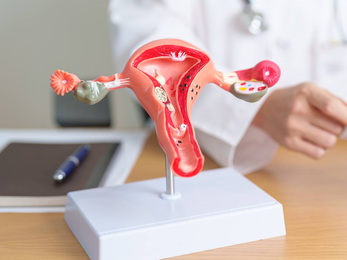 Ginecóloga explicó cuáles síntomas indicarían que debería hacerse una histerectomía