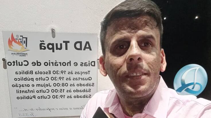 El hombre más tatuado de Brasil decidió eliminar los tatuajes de su cuerpo: “Dios cambió todo”