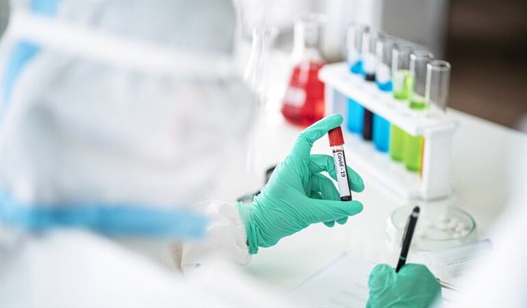 Casos de Coronavirus en Colombia. Foto: Getty Images