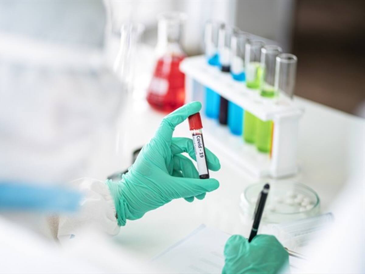 Coronavirus en Colombia: 3.381 casos nuevos y 110 fallecidos para este domingo