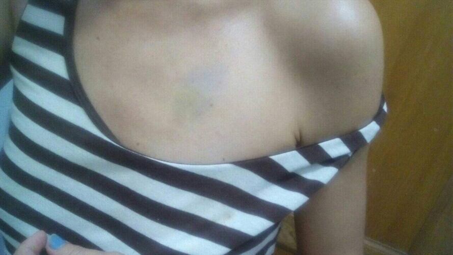 Para presentar la denuncia formal ante la Fiscalía, debe aportar los videos de las cámaras de seguridad del pasillo y el ascensor . Foto: Cortesía: Claudia Gadban Campiño