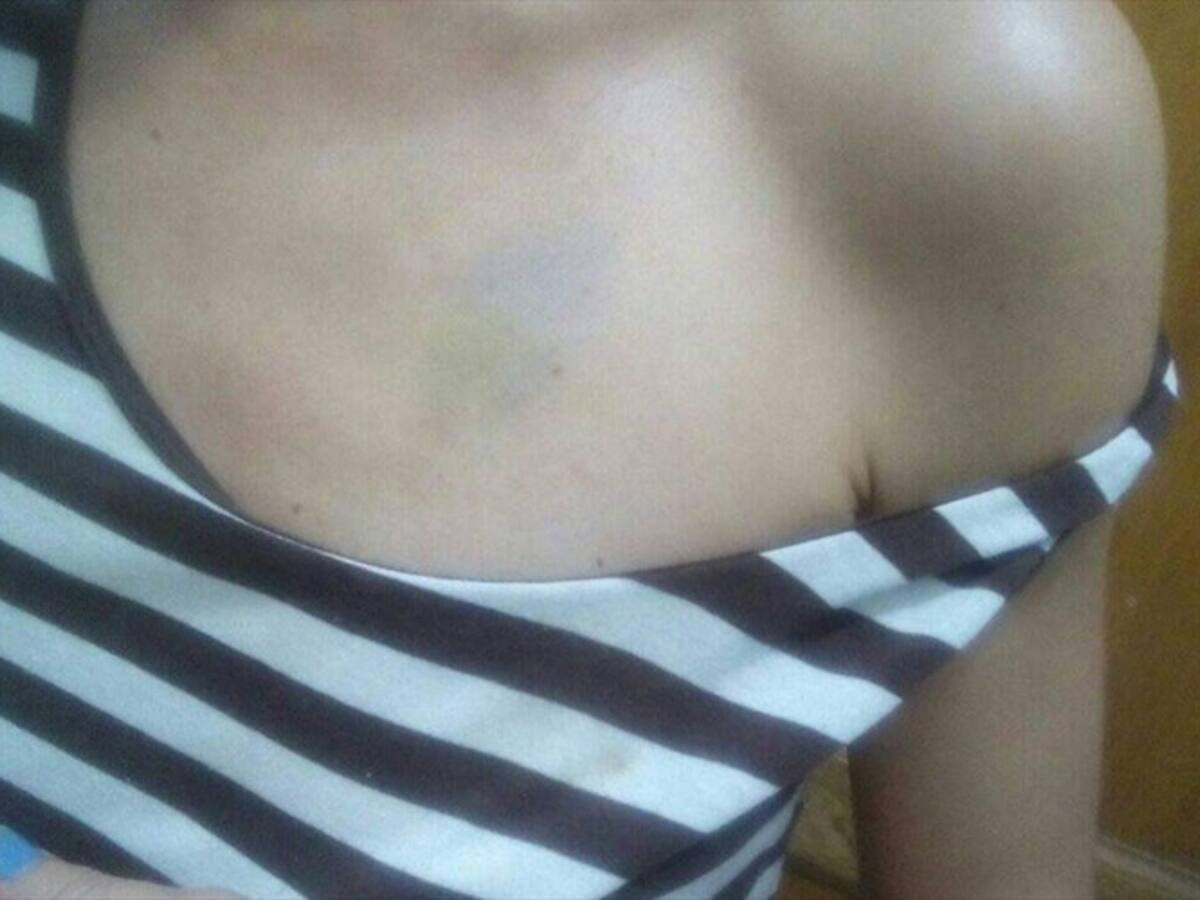 Por pedir uso tapabocas, pareja de turistas golpea a mujer en Santa Marta