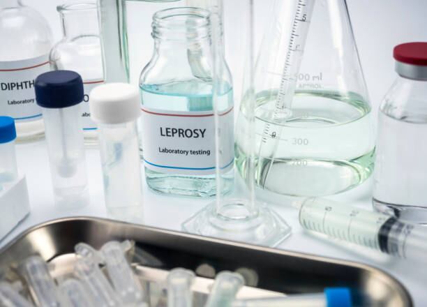 Test leprosy in laboratory, conceptual image