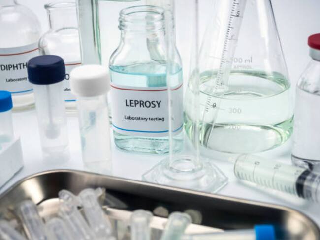 Test leprosy in laboratory, conceptual image