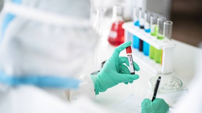 Casos de COVID-19 en Colombia. Foto: Getty Images