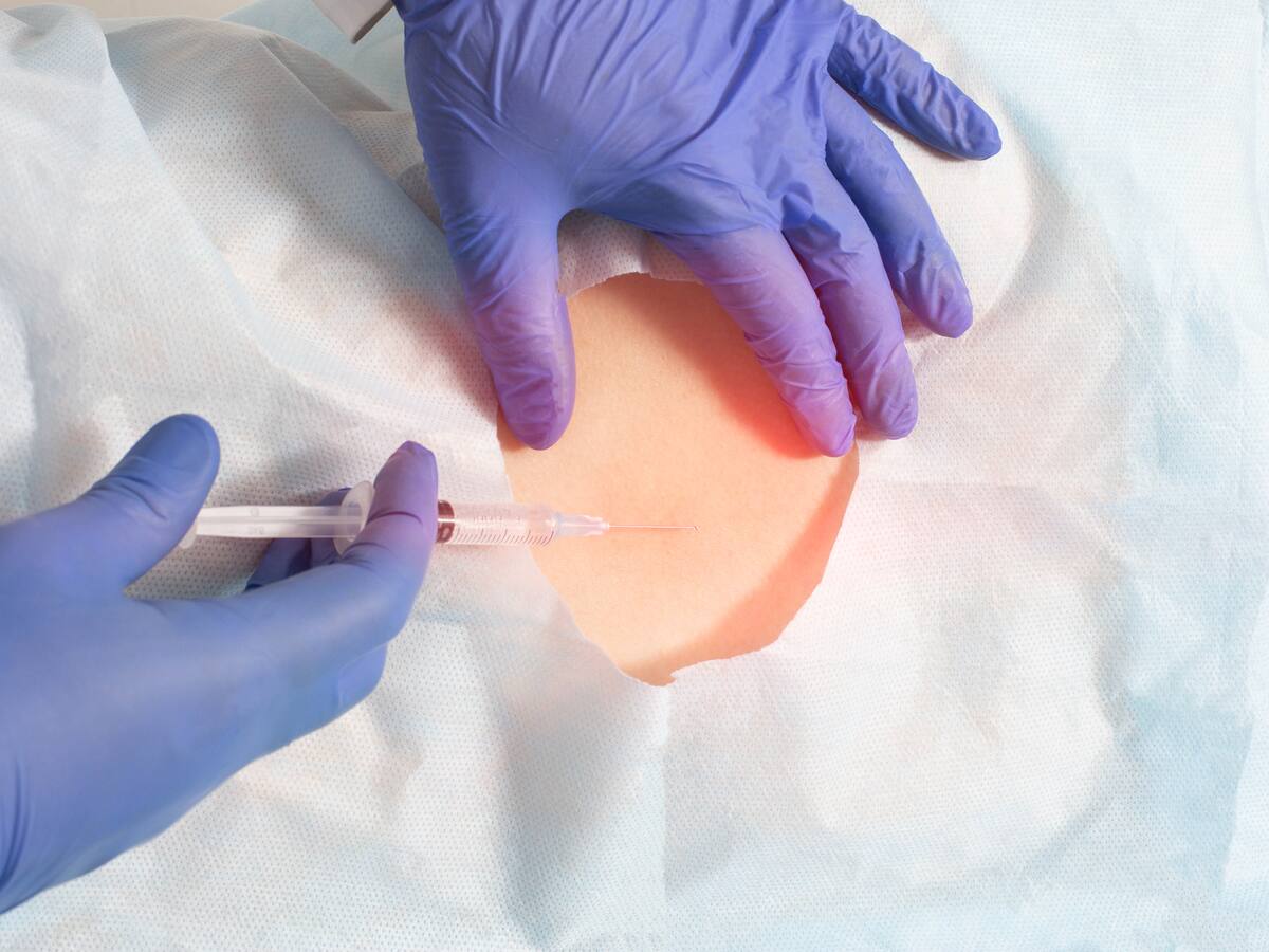 Bloqueo del dolor: ¿En qué consiste y en qué casos se puede aplicar?