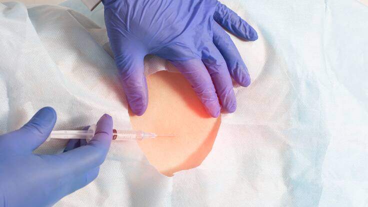 Bloqueo del dolor: ¿En qué consiste y en qué casos se puede aplicar?