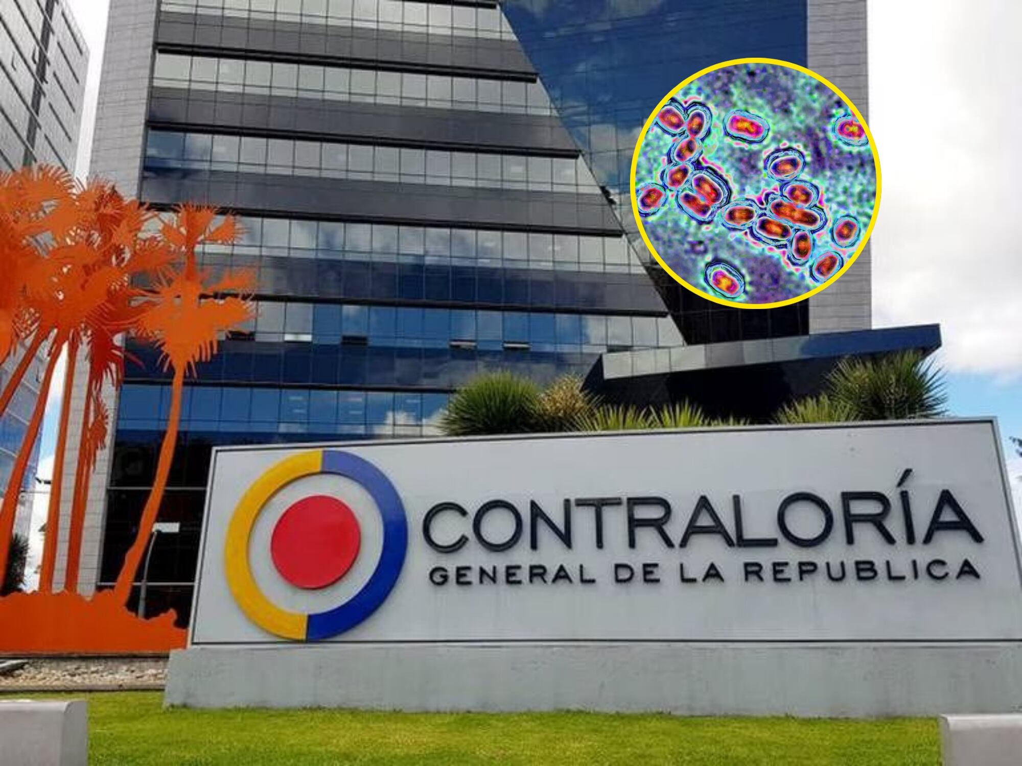 Meningitis bacteriana en la Contraloría. Fotos: Suministrada y Getty Images.