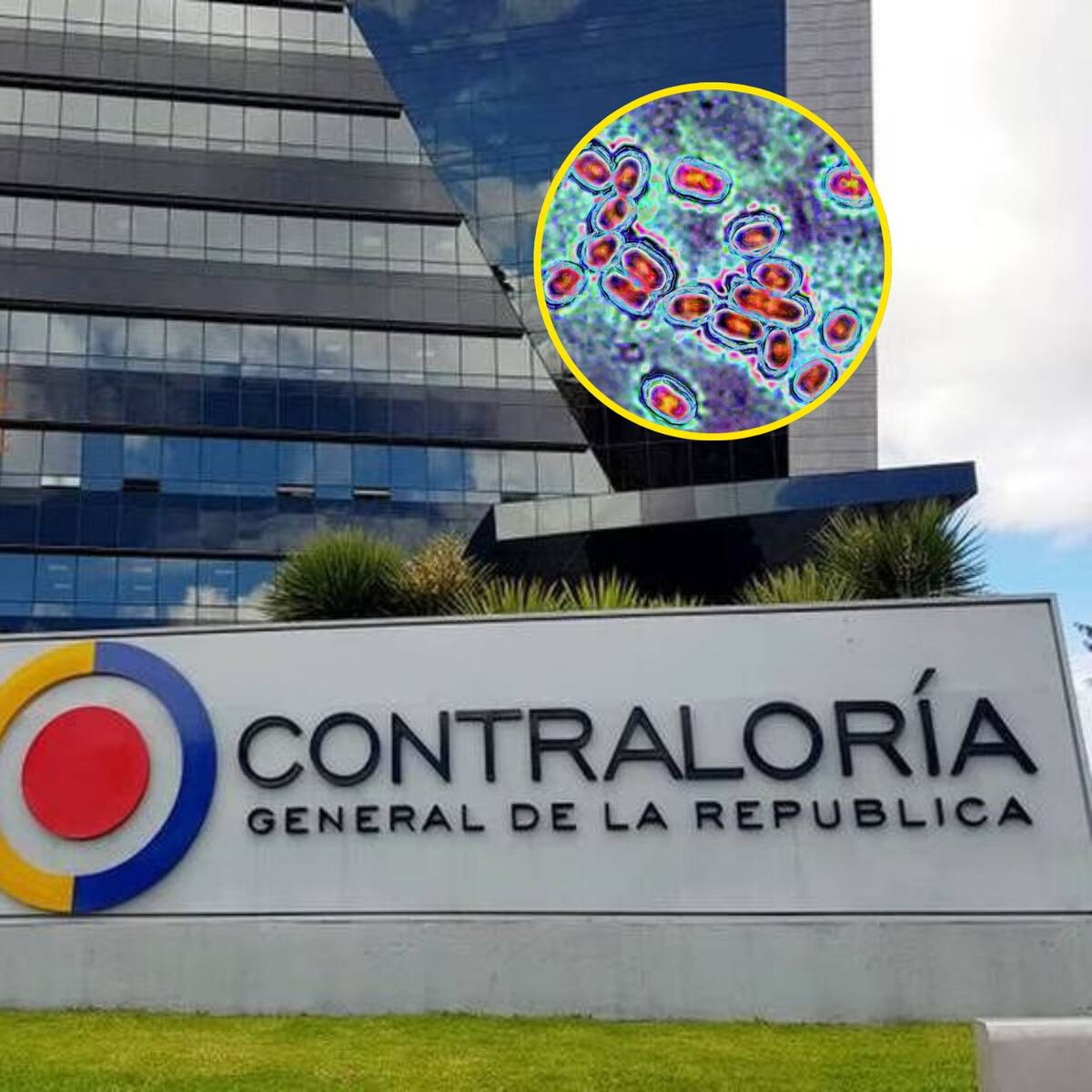 Envían a trabajo en casa a funcionarios de la Contraloría por caso de meningitis bacteriana