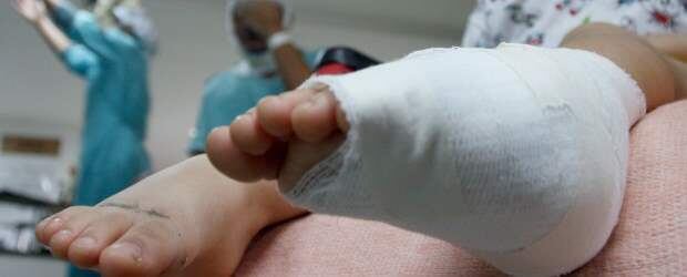 Imagen de referencia de un menor con quemaduras. Foto: Colprensa.