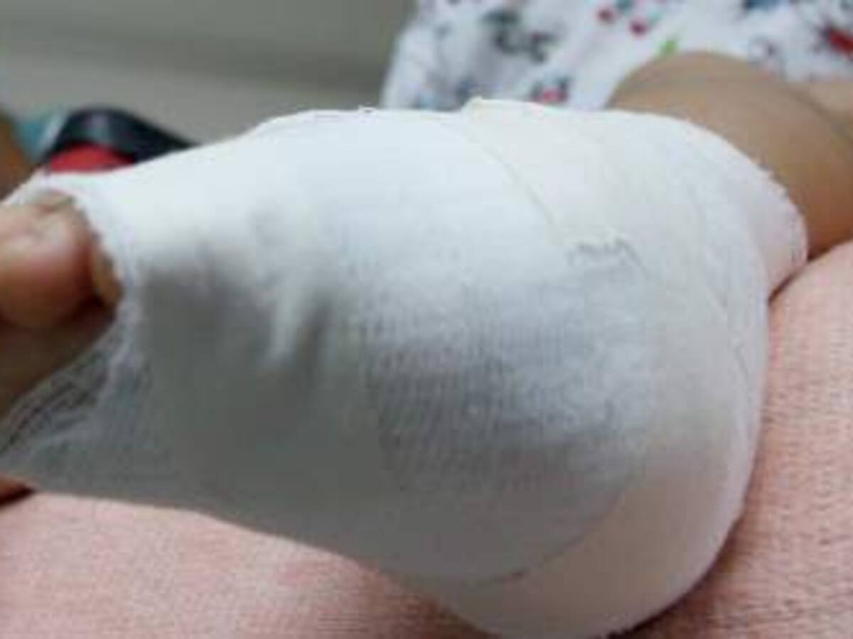 Murió niño de 11 años por explosión de polvorería en Roldanillo, Valle del Cauca