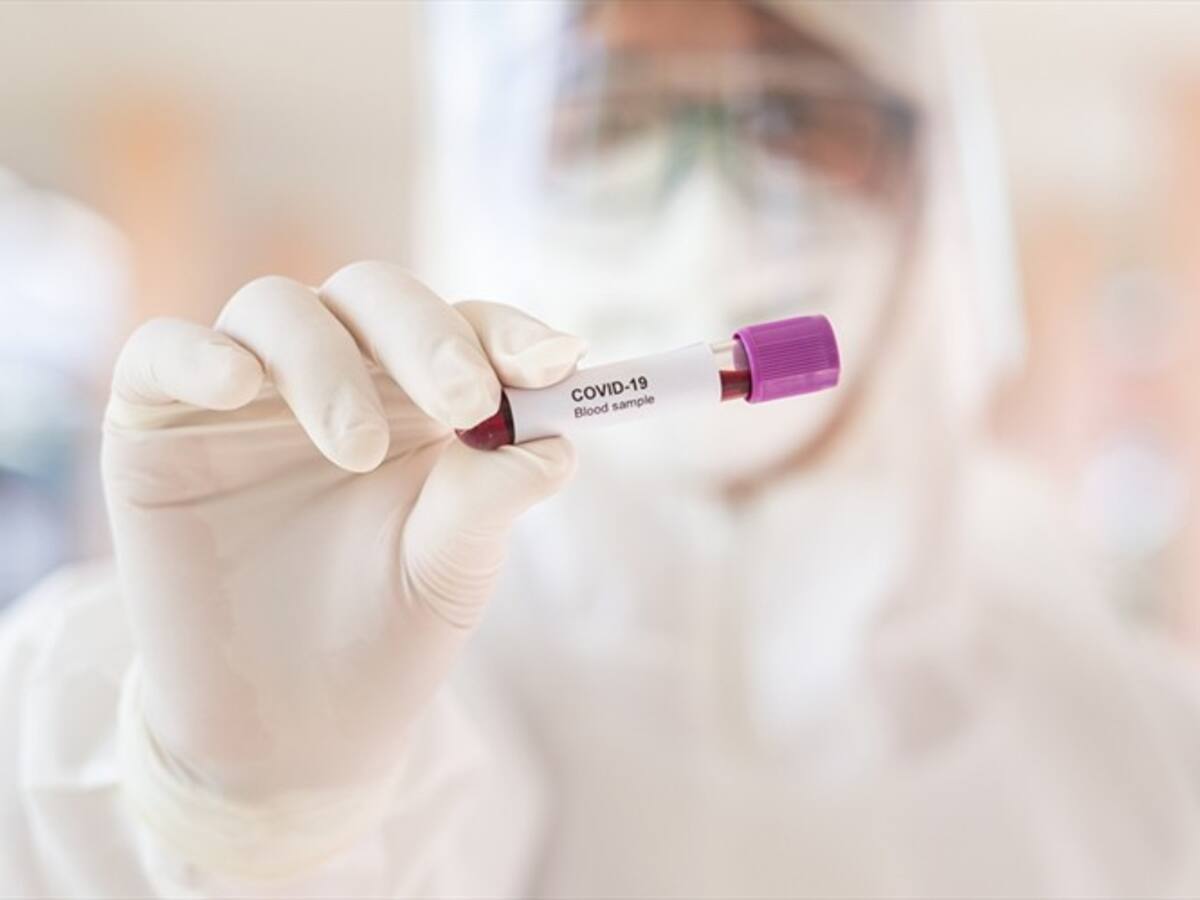 Policía de Montería confirma el primer caso positivo de COVID-19 en la institución