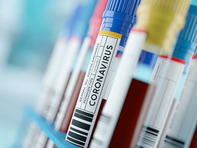 En Bogotá y 26 departamentos están represadas 15.053 pruebas para COVID-19 que no han sido procesadas. Foto: Getty Images