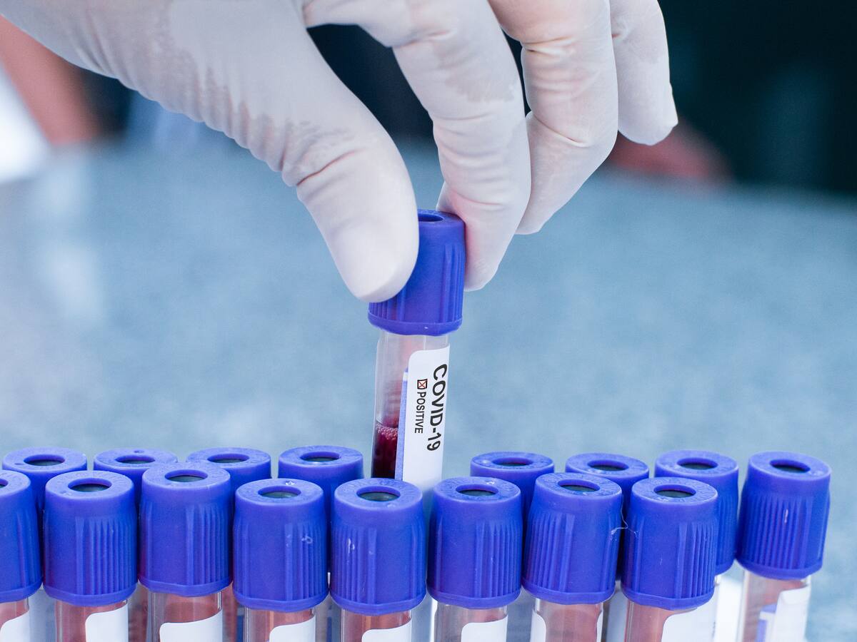 COVID-19 en Colombia: este miércoles se reportaron 327 casos nuevos