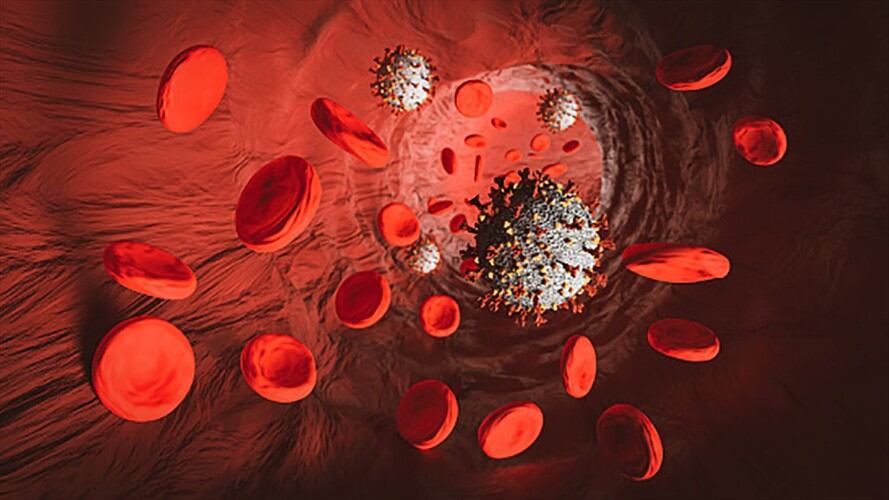 Los anticoagulantes podrían ser el tratamiento para casos graves de coronavirus . Foto: Getty Images