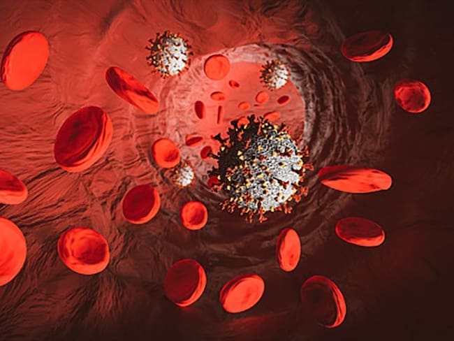 Los anticoagulantes podrían ser el tratamiento para casos graves de coronavirus . Foto: Getty Images