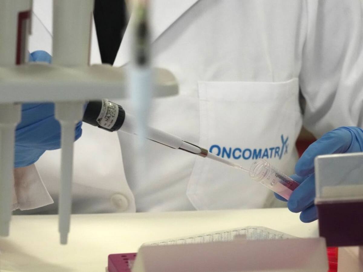 Oncomatryx probará en hospitales de España y EE.UU. un anticuerpo contra cáncer