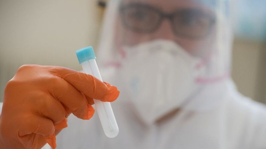 ¿Es el remdesivir un tratamiento efectivo en todos los casos de coronavirus?. Foto: Getty Images