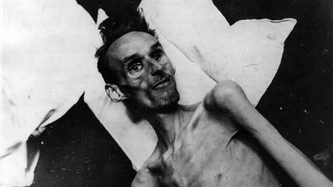 La hambruna holandesa causó estragos en un sector de la población y modificó para siempre la salud de muchos sobrevivientes.. Foto: BBC Mundo